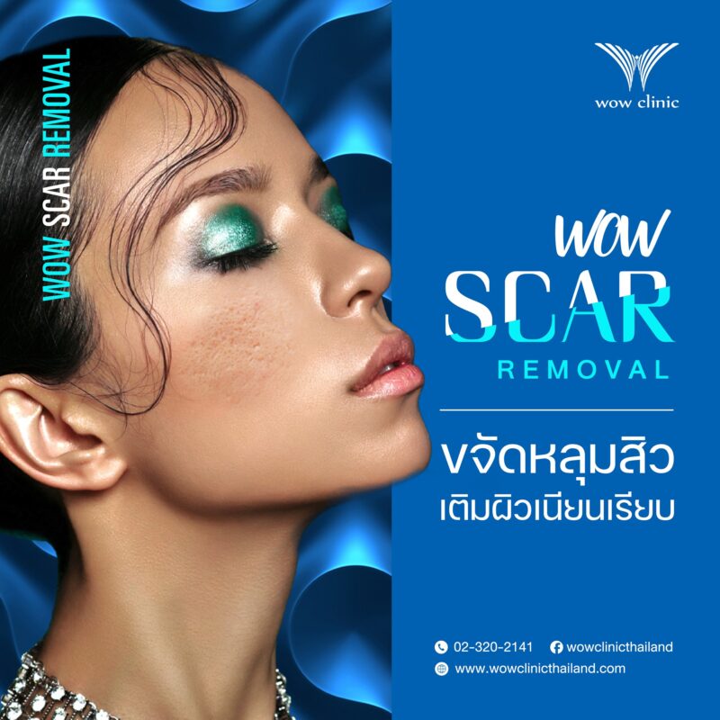 scar