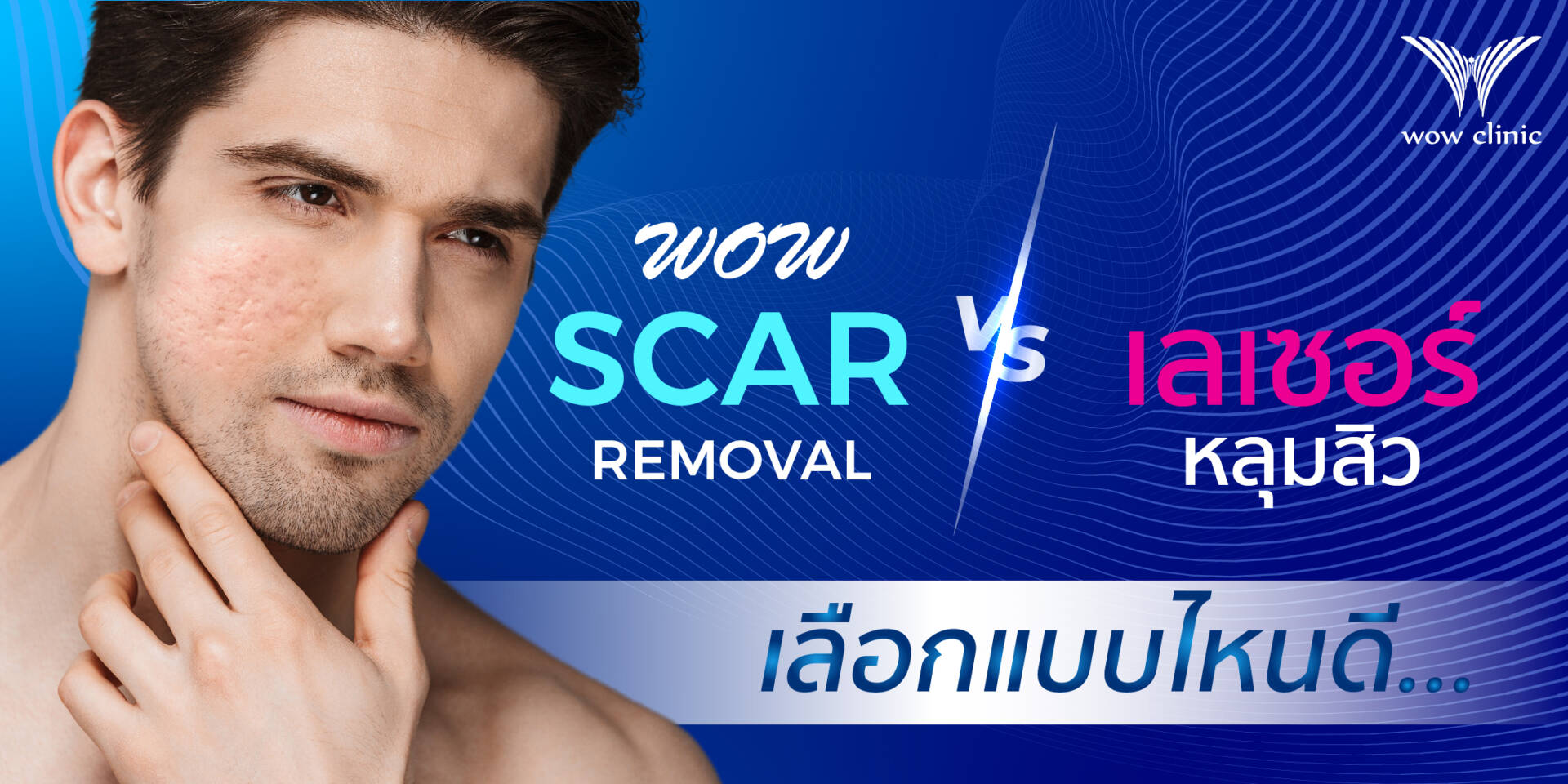 WOW SCAR REMOVAL ดีกว่า เลเซอร์หลุมสิวอย่างไร ?