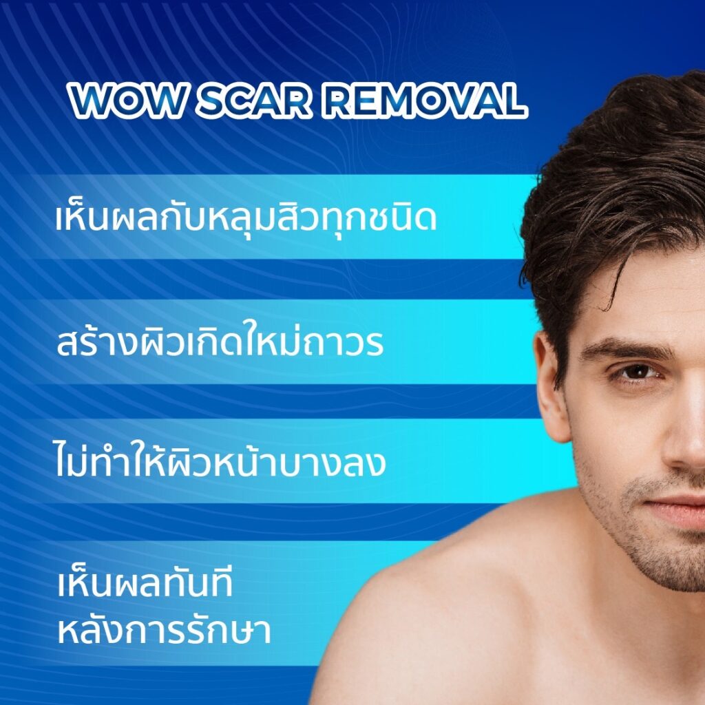 WOW SCAR REMOVAL