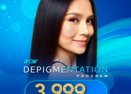 Example Promotion 4