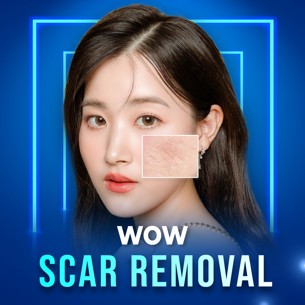 WOW Scar Removal