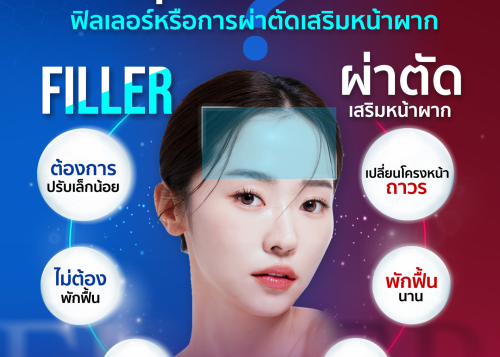 ฟิลเลอร์หน้าผาก VS ผ่าตัดเสริมซิลิโคนหน้าผาก แบบไหนดีกว่ากัน?