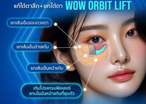 เทคนิค WOW ORBIT LIFT คืออะไร?