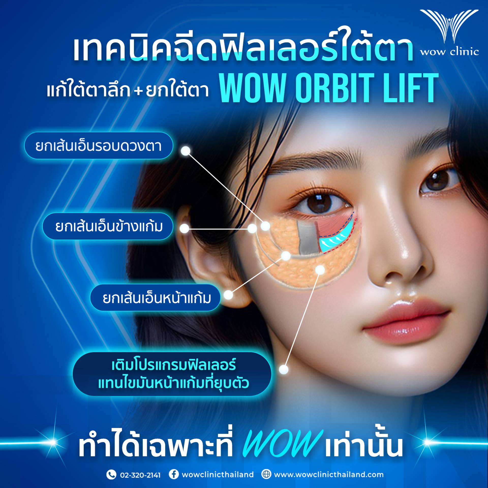 เทคนิค WOW ORBIT LIFT✨ ที่ WOW ทำได้แค่ที่เดียวคืออะไร? เดี๋ยวจะเล่าให้ฟังค๊าาา💖 "WOW ORBIT LIFT" คือเทคนิคที่ช่วยยกเส้นเอ็นรอบดวงตา เส้นเอ็นข้างแก้ม เส้นเอ็นหน้าแก้ม และเติมโปรแกรมฟิลเลอร์แทนไขมันหน้าแก้มที่ยุบตัว ทำให้ผลลัพธ์ใต้ตา ออกมาสวยละมุน ไม่เป็นก้อน ที่สำคัญคือเทคนิคนี้ "มีแค่ที่ WOW เท่านั้น!"