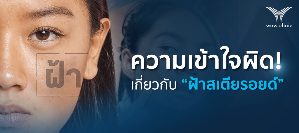ความเข้าใจผิดเกี่ยวกับ ฝ้าสเตียรอยด์​