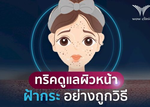 ทริคดูแล หน้าเป็นฝ้ากระ อย่างถูกวิธี