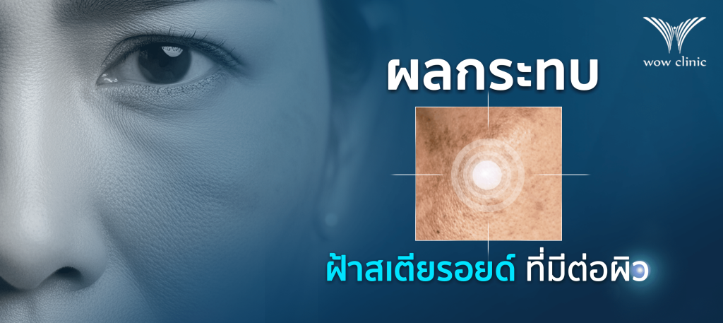 ผลกระทบของ ฝ้าสเตียรอยด์ ต่อผิว​