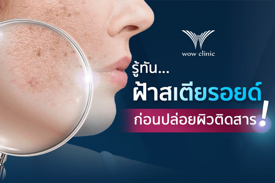 รู้ทัน ฝ้าสเตียรอยด์ ก่อนปล่อยผิวติดสาร