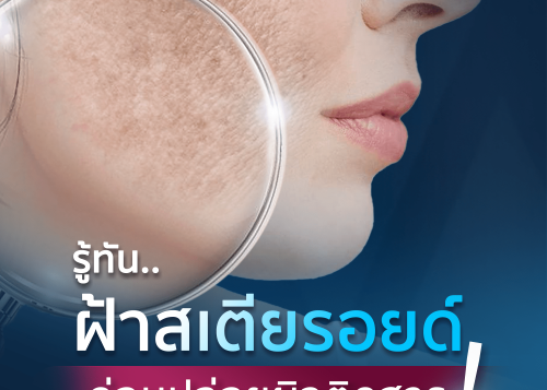 รู้ทัน ฝ้าสเตียรอยด์ ก่อนปล่อยผิวติดสาร