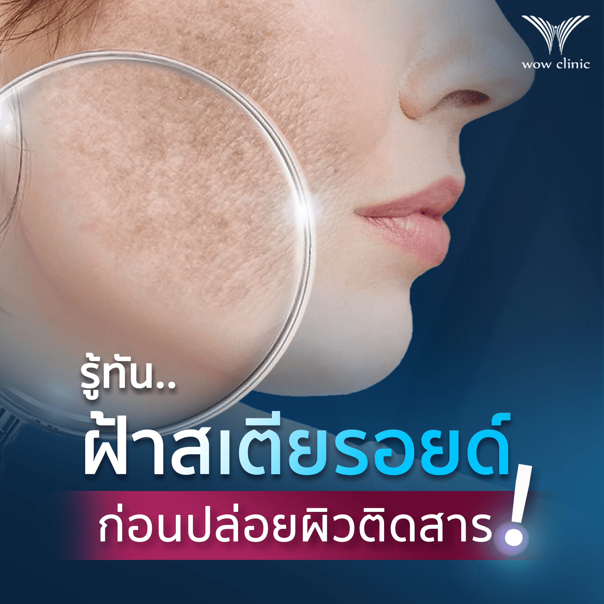 รู้ทัน ฝ้าสเตียรอยด์ ก่อนปล่อยผิวติดสาร