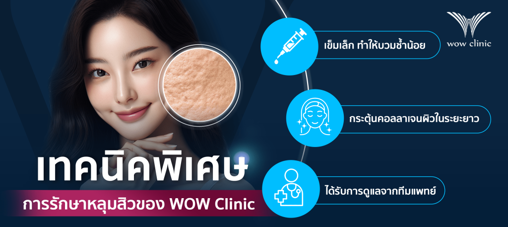 เทคนิคพิเศษการรักษาหลุมสิวของ WOW Clinic