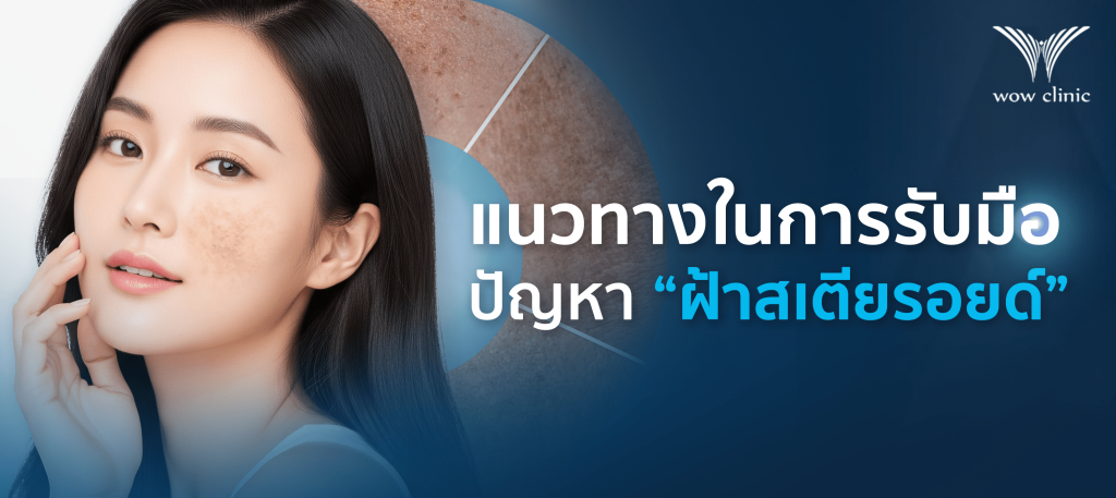 แนวทางในการรับมือกับปัญหา ฝ้าสเตียรอยด์ ​