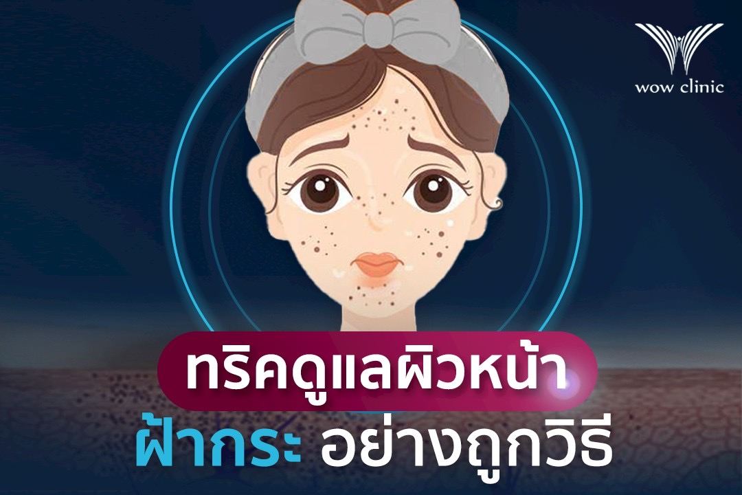 ทริคดูแล หน้าเป็นฝ้ากระ อย่างถูกวิธี
