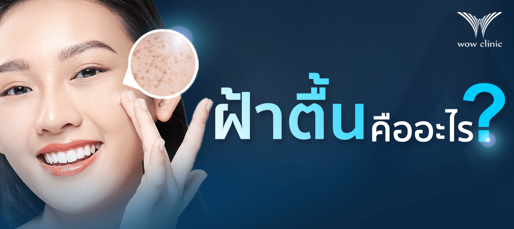 ฝ้าตื้น คืออะไร