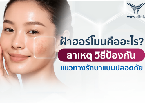 ฝ้าฮอร์โมนคืออะไร? สาเหตุ วิธีป้องกัน และแนวทางรักษาฝ้าแบบปลอดภัย