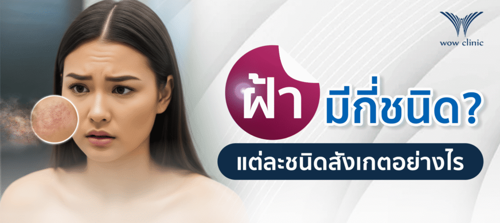 ฝ้าบนใบหน้า มีกี่ชนิด แต่ละชนิดสังเกตอย่างไร