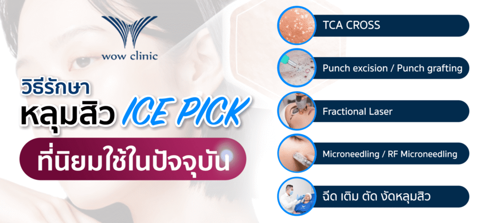 วิธีรักษา หลุมสิว Ice pick ที่นิยมใช้ในปัจจุบัน