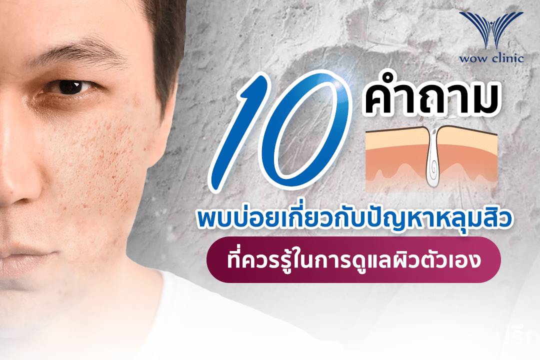 หน้าเป็นหลุมสิว กับ 10 คำถามที่พบบ่อยที่ควรรู้ไว้