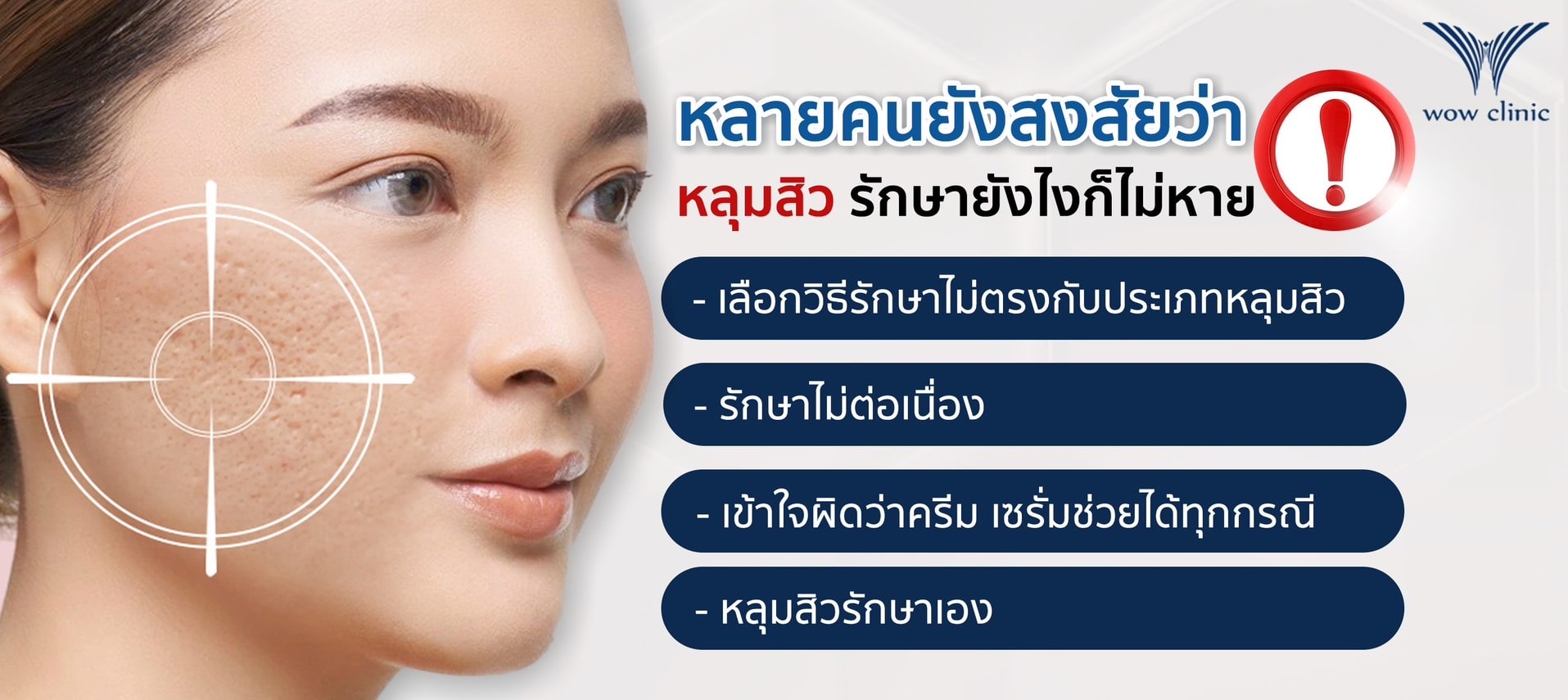 ทำไมหลายคนยังสงสัยว่า หลุมสิวรักษายังไง ก็ไม่หาย