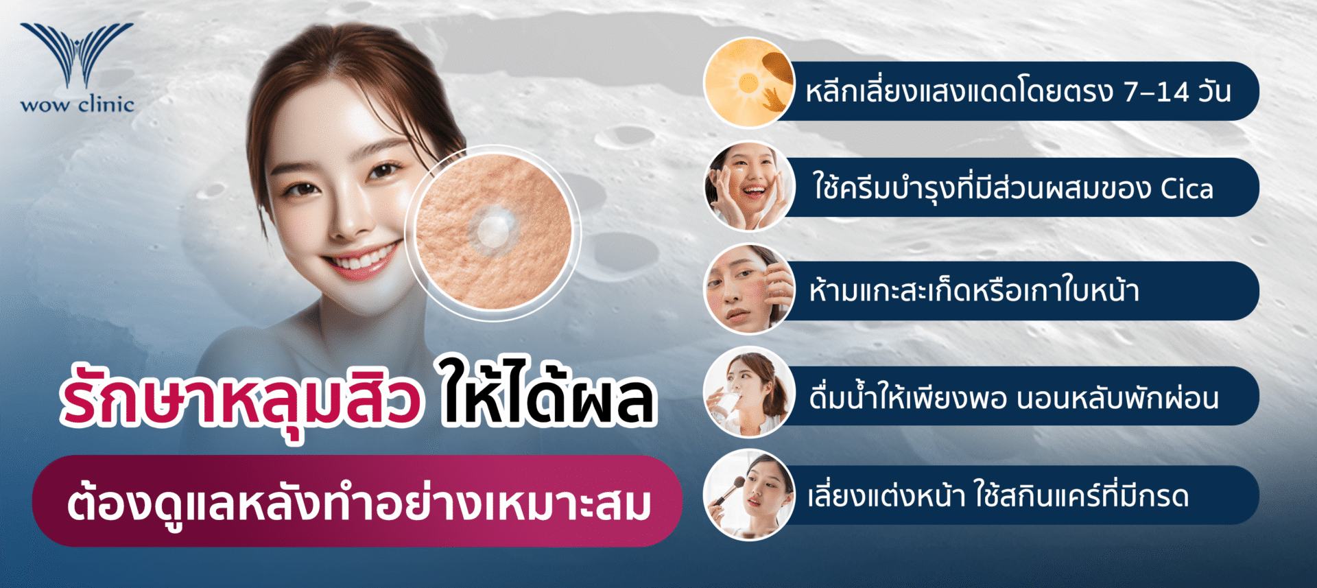 วิธีรักษาหลุมสิว ให้มีประสิทธิภาพต้องควบคู่การดูแลหลังทำอย่างเหมาะสม