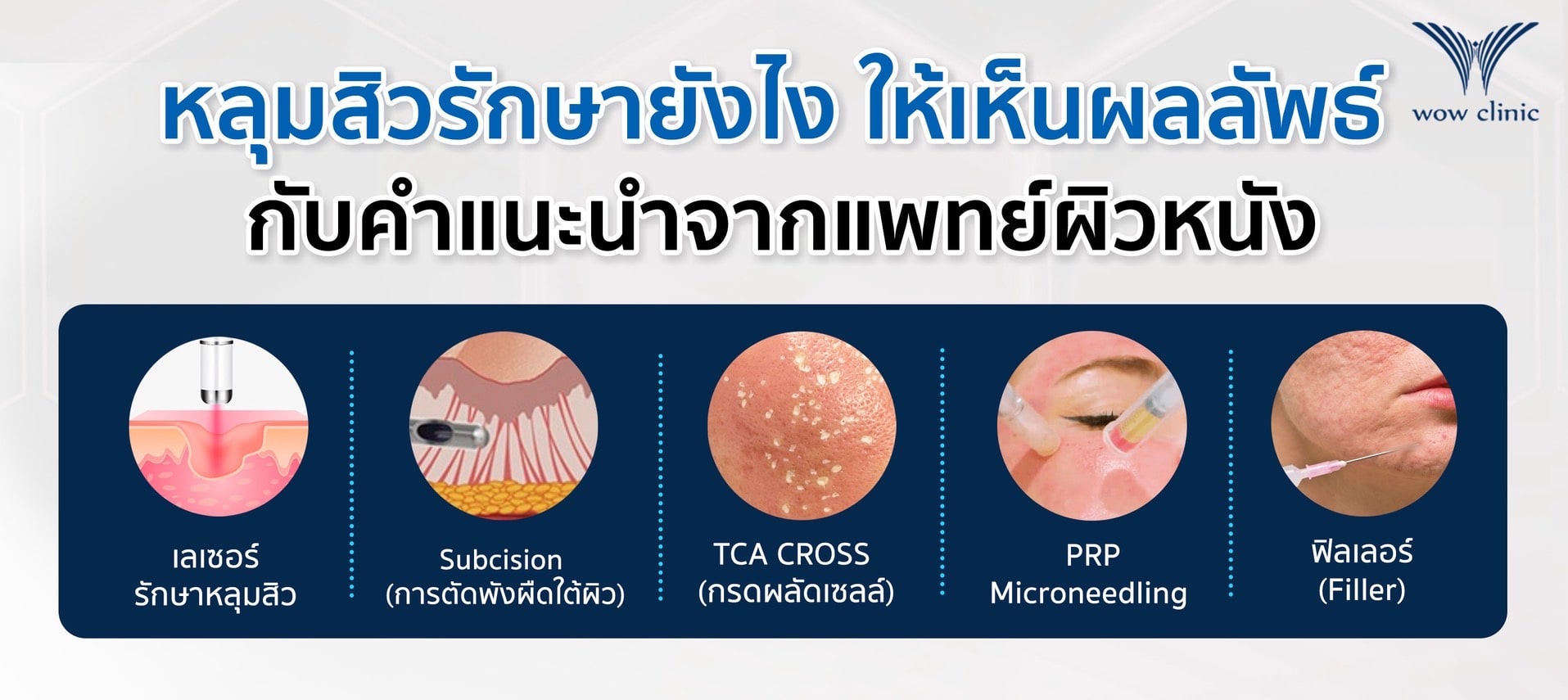 หลุมสิวรักษายังไง ให้เห็นผลลัพธ์ กับคำแนะนำจากแพทย์ผิวหนัง