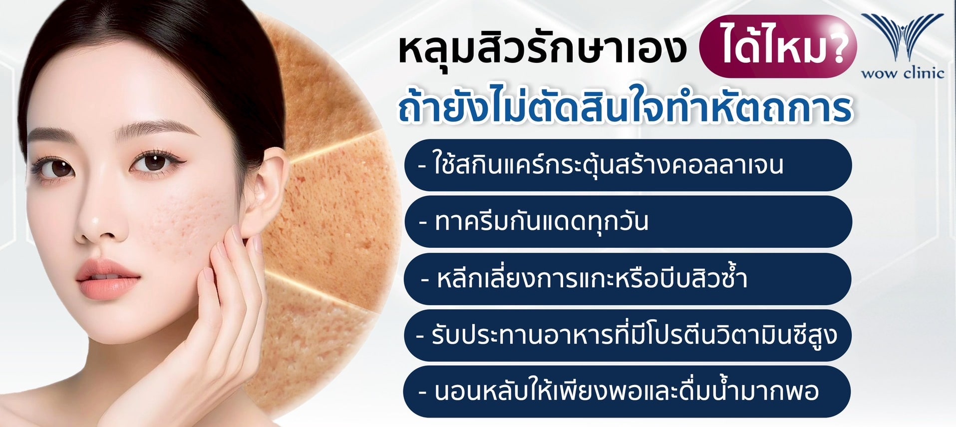 หลุมสิวรักษาเอง ได้ไหม? ถ้ายังไม่ตัดสินใจทำหัตถการ
