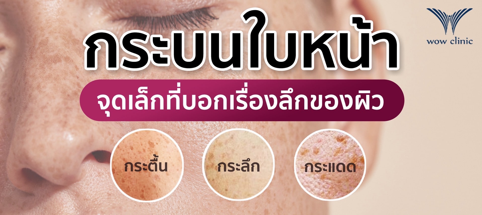 กระบนใบหน้า จุดเล็กที่บอกเรื่องลึกของผิว