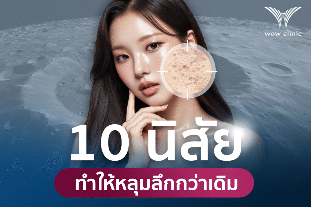 หลุมสิว กับ 10 นิสัยที่ทำให้หลุมลึกกว่าเดิม