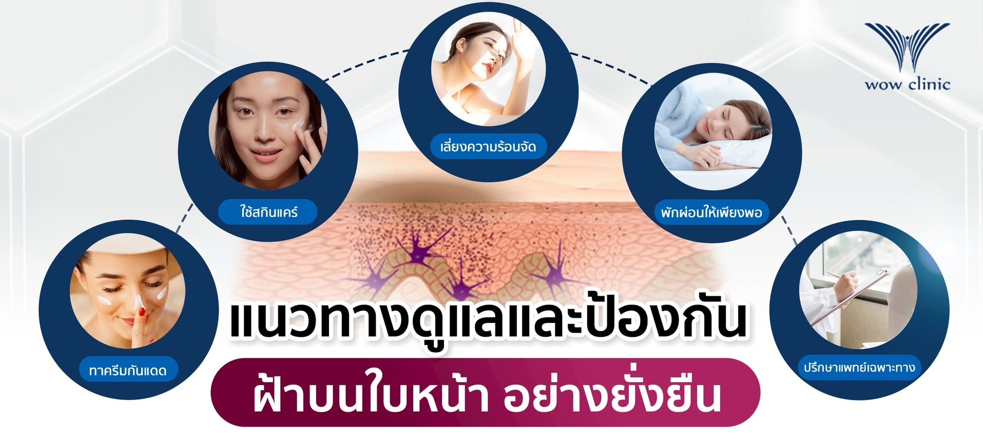 แนวทางดูแลและป้องกัน ฝ้าบนใบหน้า อย่างยั่งยืน