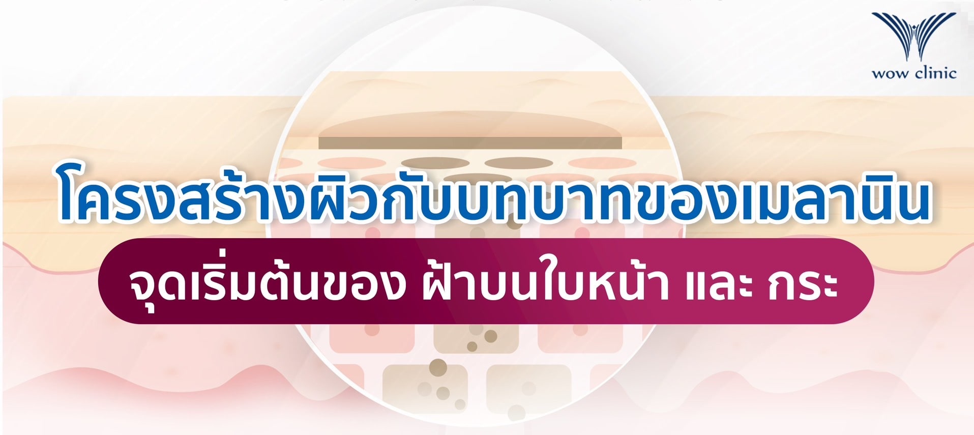 โครงสร้างผิวกับบทบาทของเมลานิน จุดเริ่มต้นของ ฝ้าบนใบหน้า และ กระ